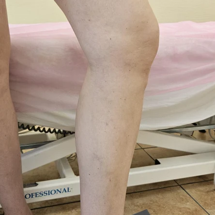 Алёна после