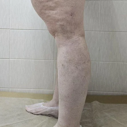 Людмила после