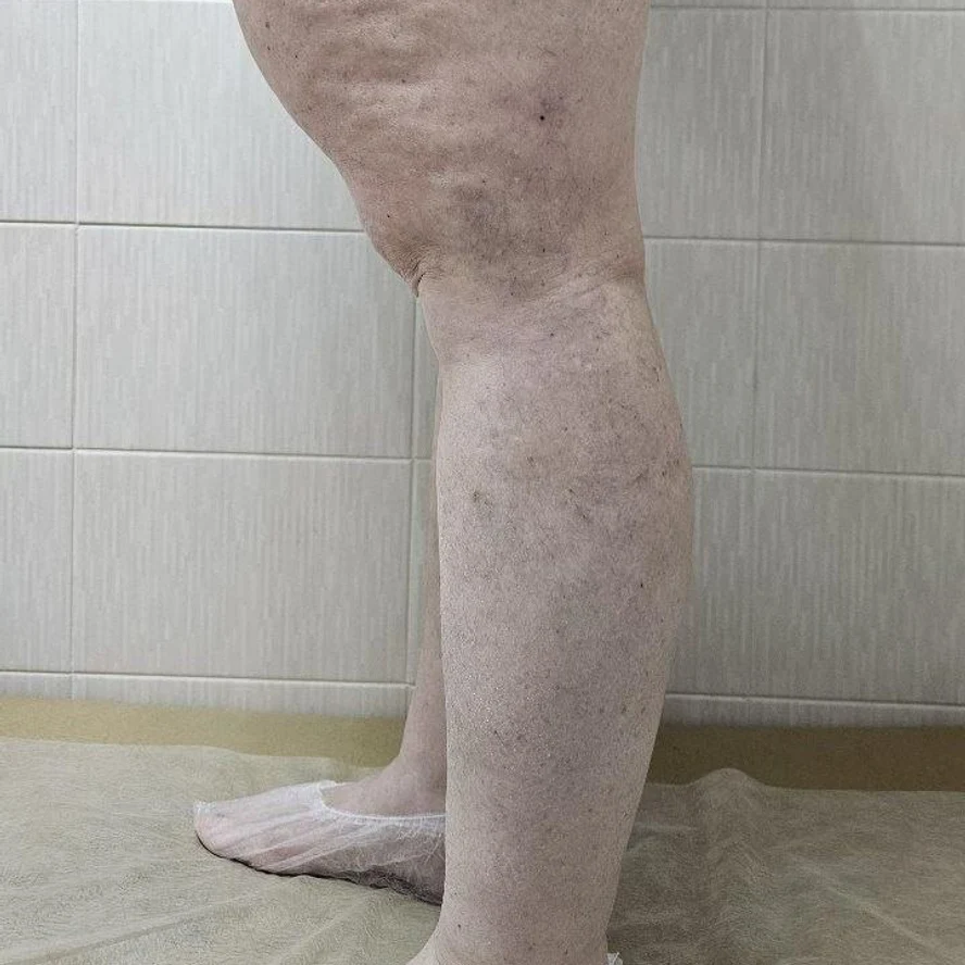 Людмила после
